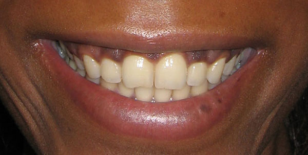 Case 3 — Whitening & Reshaping — before